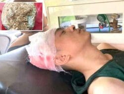 Gawat! Sartika Dilempar Batu Koral, Alwi Tewas di Rumah Sakit