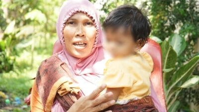 Wali Kota Medan Kembalikan Senyum Manis Salwa Pascaoperasi Palatoskizis
