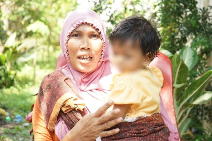 Wali Kota Medan Kembalikan Senyum Manis Salwa Pascaoperasi Palatoskizis